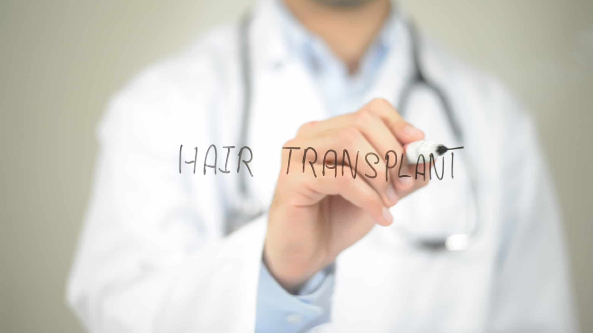 hair transplant