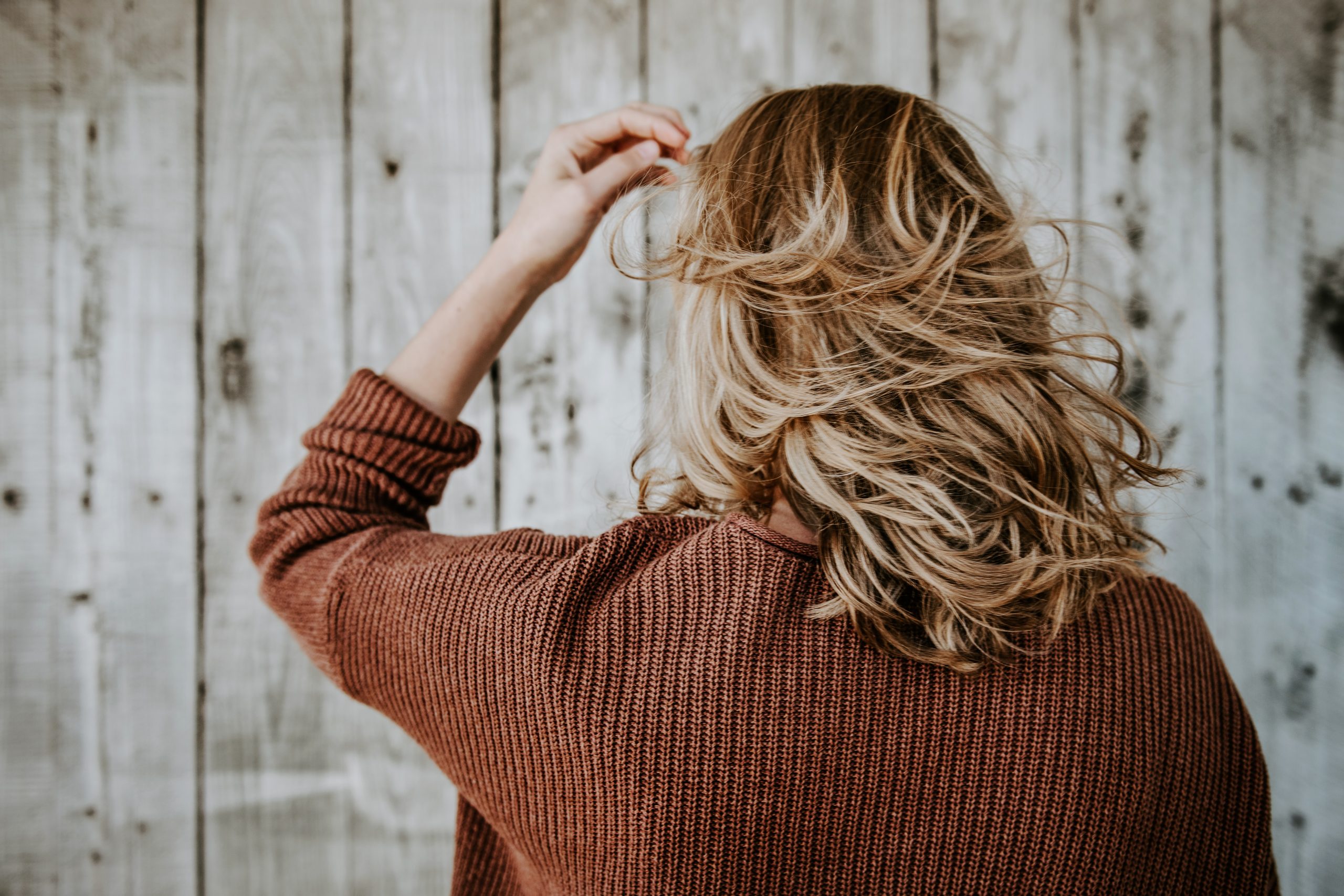 alopecia femenina