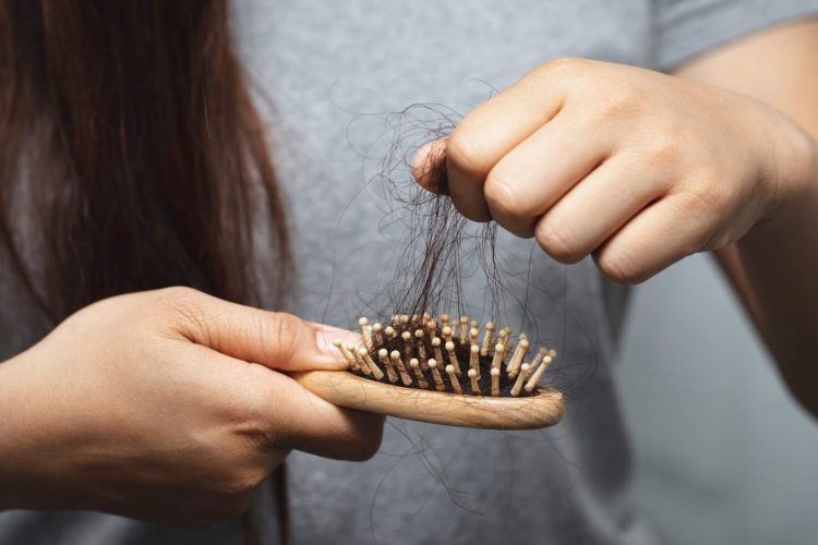 Es-normal-la-caida-del-cabello-en-verano-en-mujeres